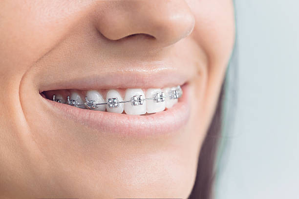 Best Traditional Braces  in Clifton, AZ